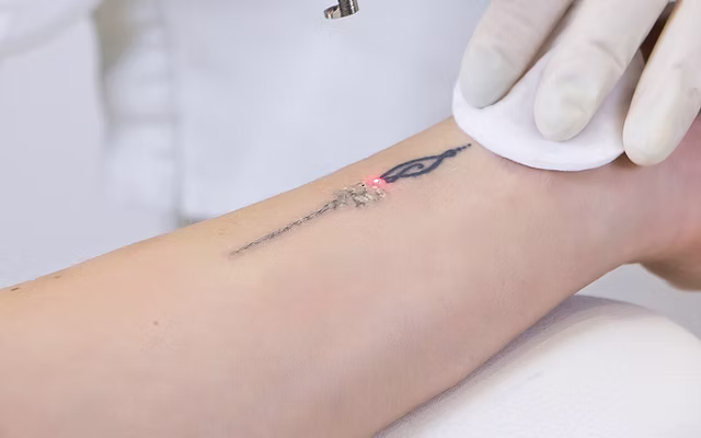 Plasma pen